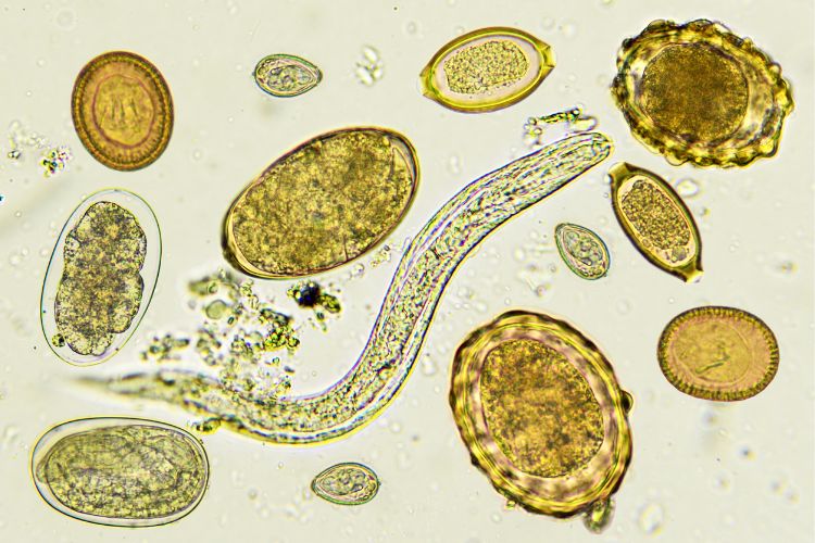 Types of Parasites