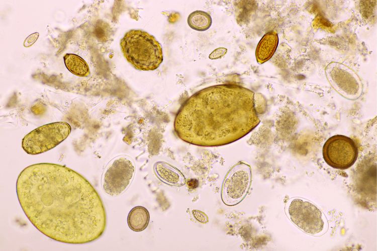 How Can I Tell If My Gut Issues Are Being Caused By A Parasite 