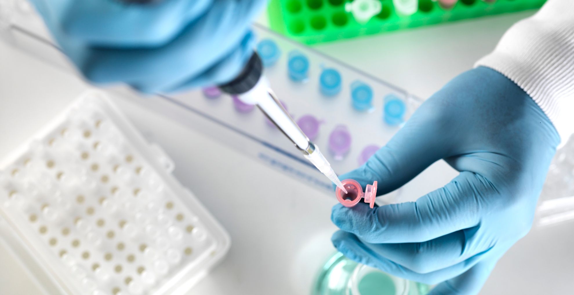 5 Benefits of Getting your Acne Tested