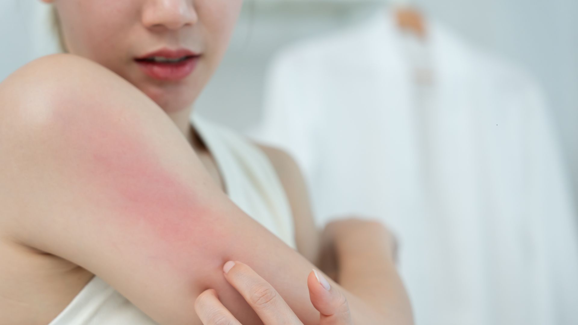 histamine intolerance showing up as a rash