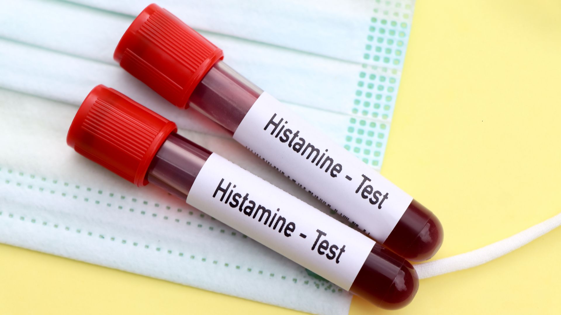 histamine blood test 